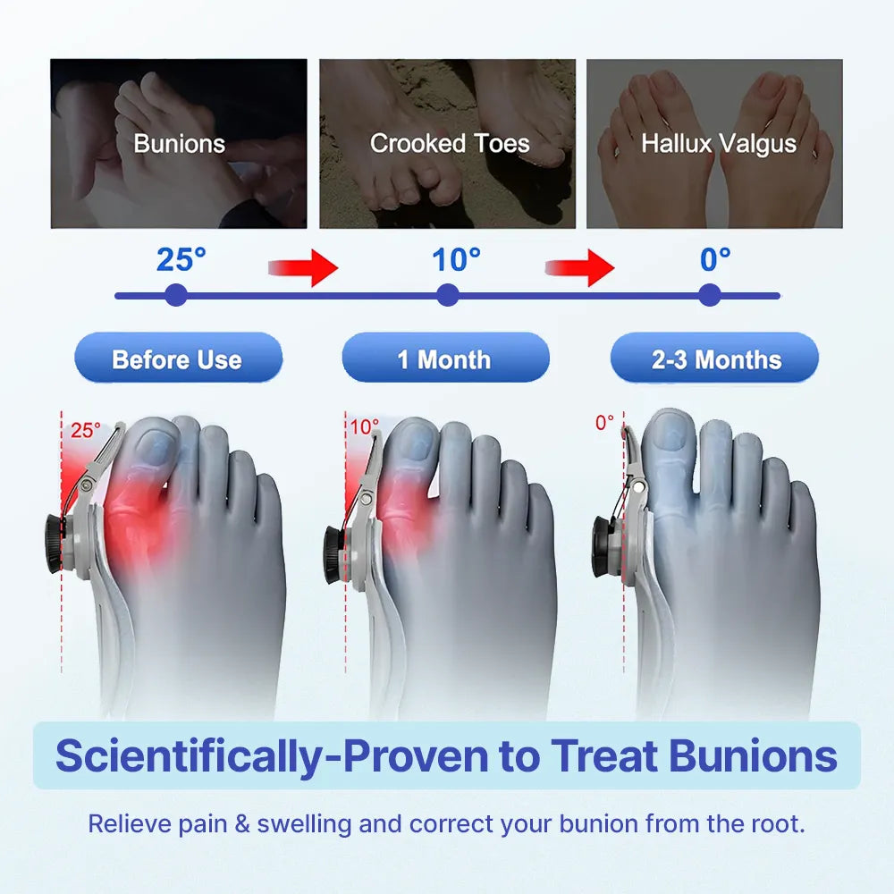 MedyPals™ Bunion Trainer